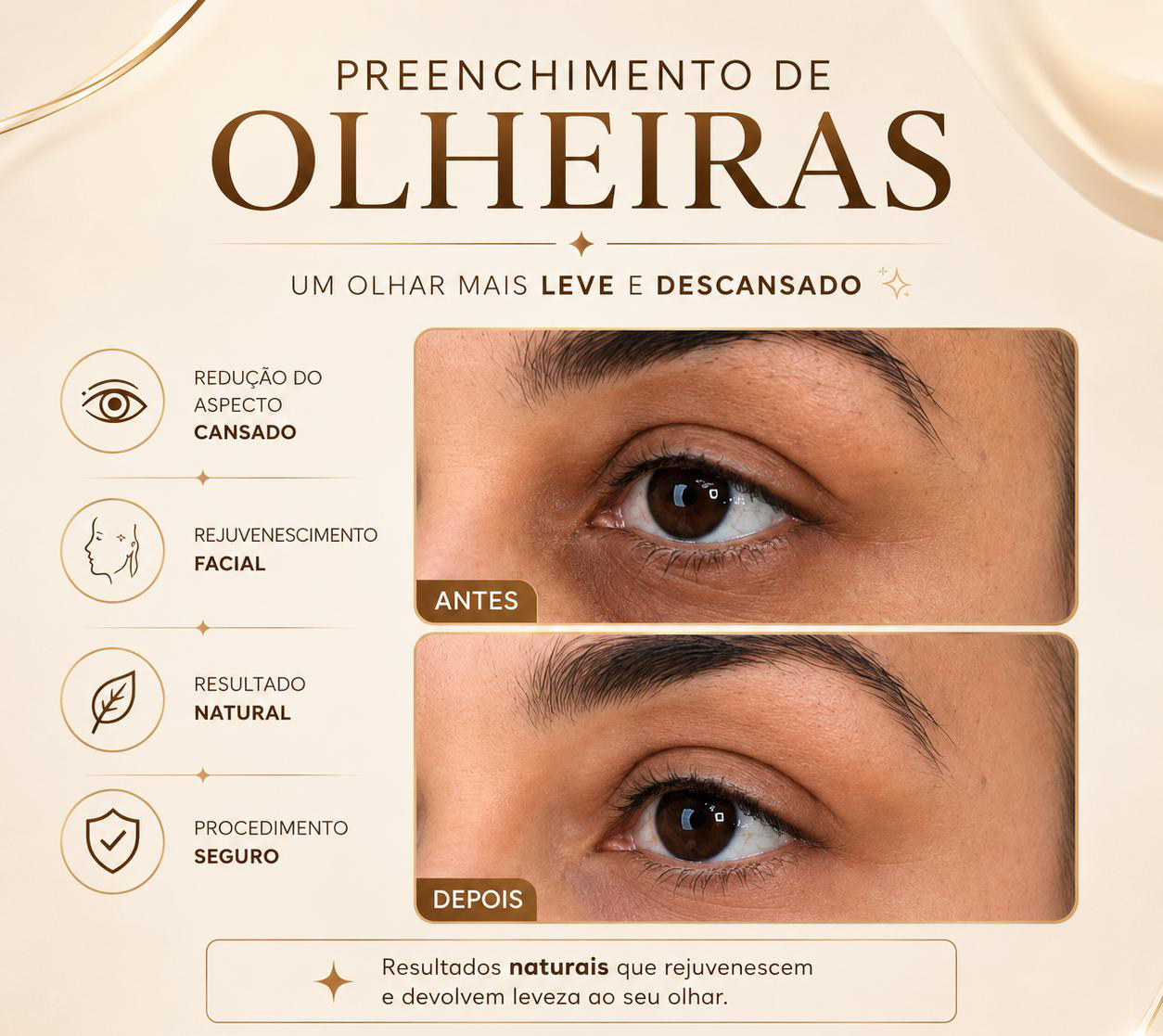 Antes e Depois 2