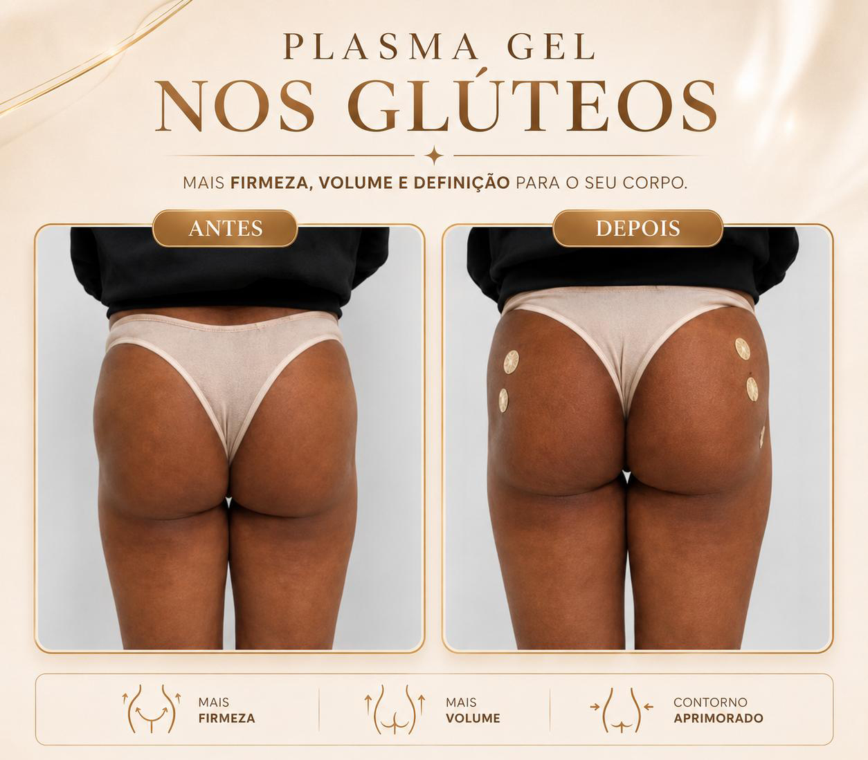 Antes e Depois 3