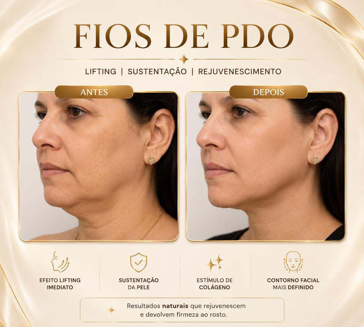 Antes e Depois 4